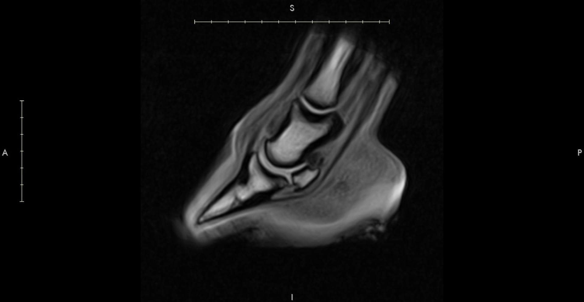 Background image - MRI